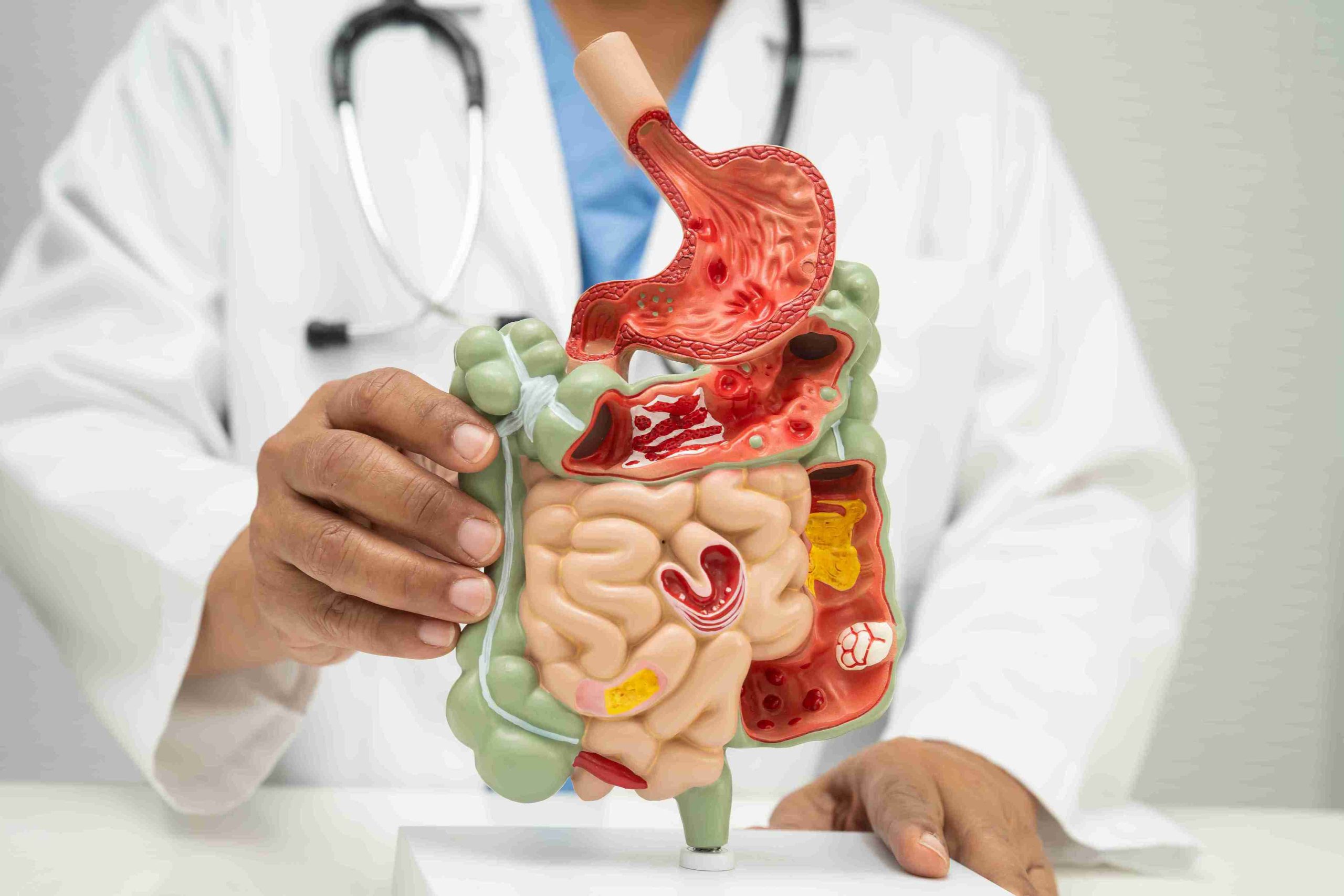Healthcare provider holding an anatomical model of the digestive system.