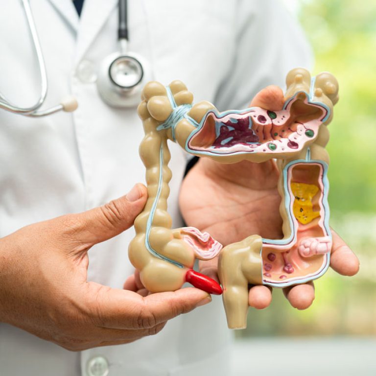 Coeliac,-Crohn’s,-Ulcerative-Colitis-and-Leaky-Gut-Support