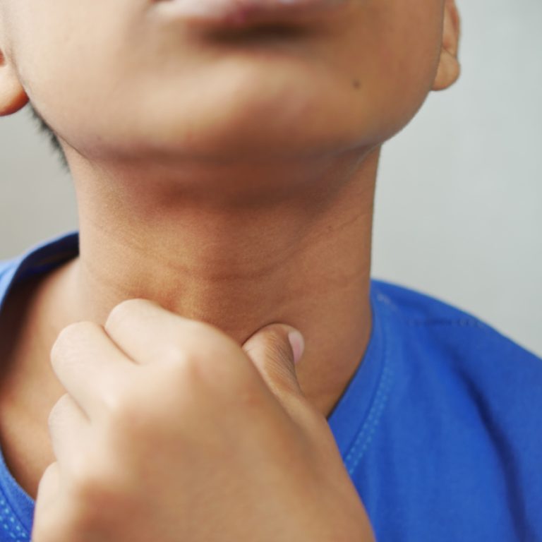 Thyroid-Disorder-Support